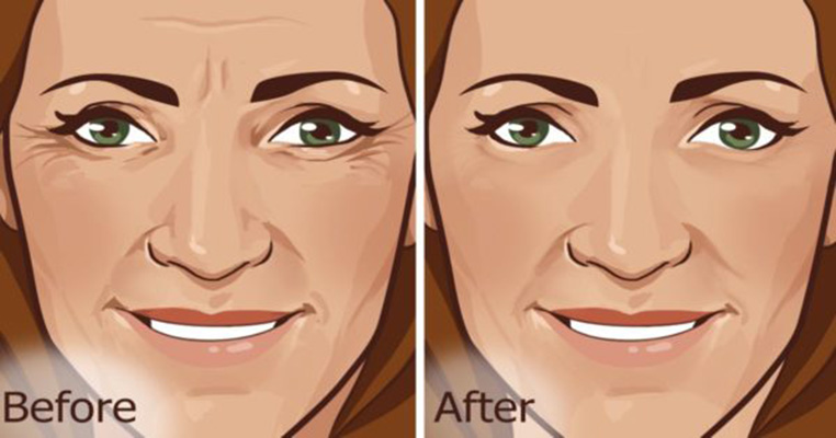Reduce Wrinkles tips tricks