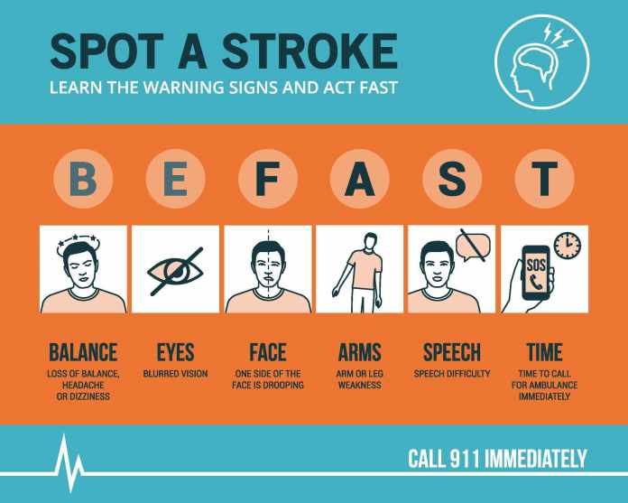 signs of a stroke