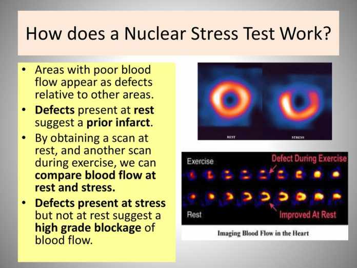 what is a nuclear stress test