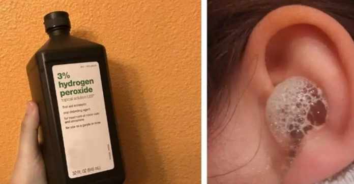 Hydrogen Peroxide In Ear