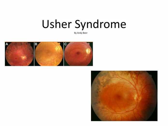 Understanding Usher Syndrome